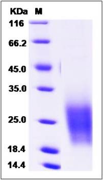 SDS-PAGE analysis of Cynomolgus TSPAN7 protein (His Tag)