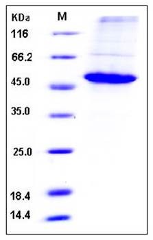 SDS-PAGE analysis of human CCNE1 His tag protein