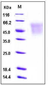 SDS-PAGE analysis of human CEACAM6 His tag protein