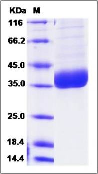 SDS-PAGE analysis of Human PPT1 protein (His Tag)