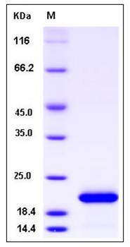 SDS-PAGE analysis of human FTH1 protein (Native)