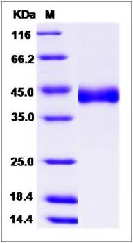 SDS-PAGE analysis of human CHST11 protein (His Tag)