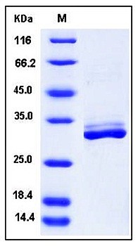 SDS-PAGE analysis of Human MYOC His tag protein