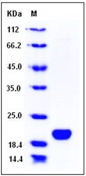 SDS-PAGE analysis of Human LCN1 His tag protein