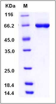 SDS-PAGE analysis of human STK40 protein (GST Tag)