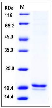 SDS-PAGE analysis of human ALOX5AP His tag protein