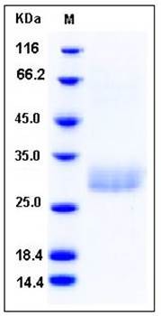 SDS-PAGE analysis of human C1QB His tag protein
