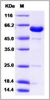 SDS-PAGE analysis of Human NCF2 protein