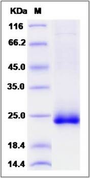 SDS-PAGE analysis of Human IFNW1 protein (His Tag)