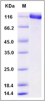SDS-PAGE analysis of mouse ENPEP protein (His Tag)