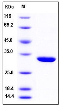 SDS-PAGE analysis of Human PNP His tag protein