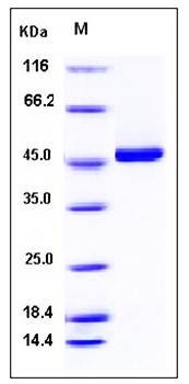 SDS-PAGE analysis of Human Kynureninase protein (His Tag)