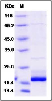 SDS-PAGE analysis of Human GUCA1A protein