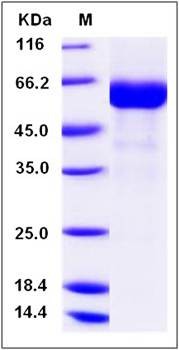 SDS-PAGE analysis of human C19ORF36 protein
