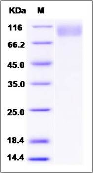 SDS-PAGE analysis of Human PDGFRB protein