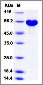 SDS-PAGE analysis of ERK3 (GST Tag) protein