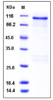 SDS-PAGE analysis of Human RSK3 GST tag protein