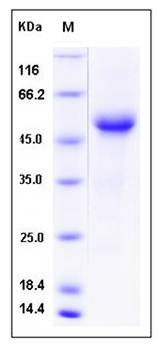 SDS-PAGE analysis of human CD8B protein