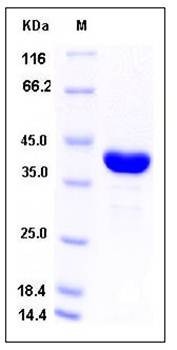 SDS-PAGE analysis of human AKR1A1 protein (His Tag)