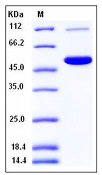 SDS-PAGE analysis of mouse CES2 His tag protein