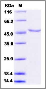 SDS-PAGE analysis of human SHPK protein