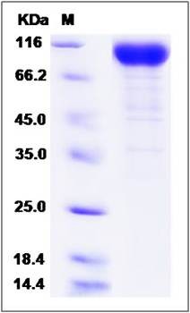 SDS-PAGE analysis of Cynomolgus IL6ST protein (His Tag)