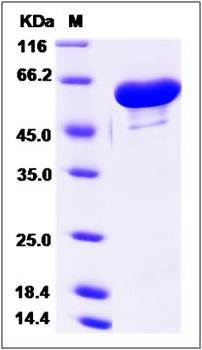 SDS-PAGE analysis of human GALNT2 protein (His Tag)