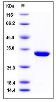 SDS-PAGE analysis of human CA7 His tag protein
