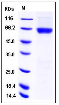 SDS-PAGE analysis of human CSNK2A1 GST tag protein