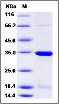 SDS-PAGE analysis of Human NMNAT2 protein (His Tag)