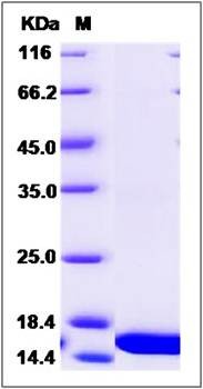 SDS-PAGE analysis of Human PFN2 protein (His Tag)