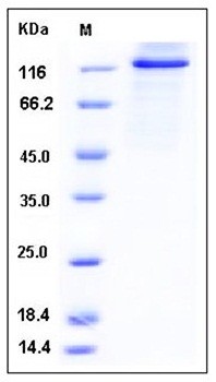 SDS-PAGE analysis of Human PRKD2 His GST tag protein