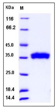 SDS-PAGE analysis of human RNASET2 protein (His Tag)