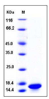 SDS-PAGE analysis of E. coli STX2B His tag protein