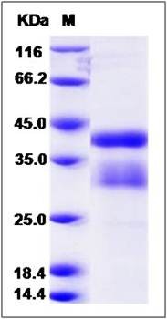 SDS-PAGE analysis of human RSPO1 protein (Native)