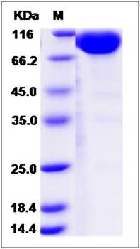 SDS-PAGE analysis of Cynomolgus IL1R1 protein