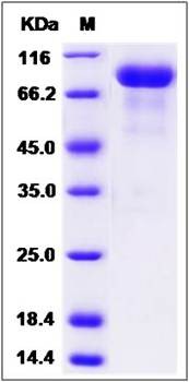 SDS-PAGE analysis of human SLITRK6 protein (His Tag)