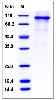 SDS-PAGE analysis of Human PDE4B His GST tag protein