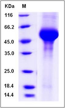 SDS-PAGE analysis of mouse GLA protein (His Tag)