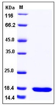 SDS-PAGE analysis of human SETD8 protein
