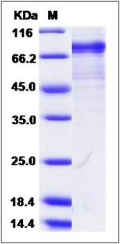 SDS-PAGE analysis of Cynomolgus CDH18 protein (His Tag)