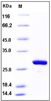 SDS-PAGE analysis of Human MAD2L1 His tag protein