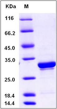 SDS-PAGE analysis of Human NT5C3 protein (Native)