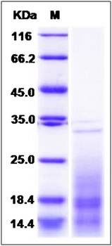 SDS-PAGE analysis of Mouse IL13 protein (Native)