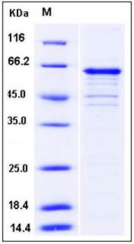 SDS-PAGE analysis of human GOLM1 His tag protein