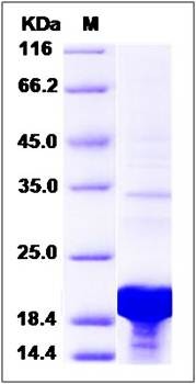 SDS-PAGE analysis of Human LSM1 protein (His Tag)