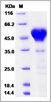 SDS-PAGE analysis of human CALU protein (His Tag)