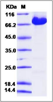 SDS-PAGE analysis of KIAA1279 protein