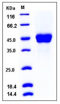 SDS-PAGE analysis of Human PTX3 His tag protein