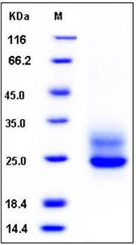 SDS-PAGE analysis of human Frizzled 5 His tag protein